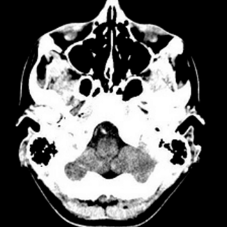 Center for Advanced Neuroimaging